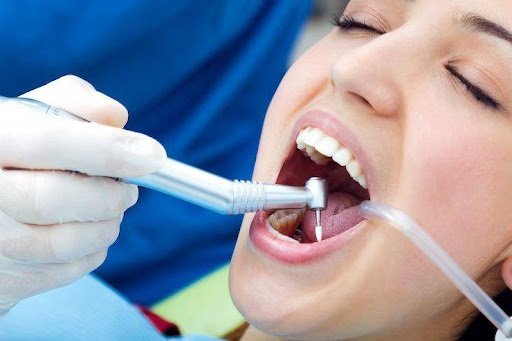 How Long Does a Root Canal Procedure Really Take?