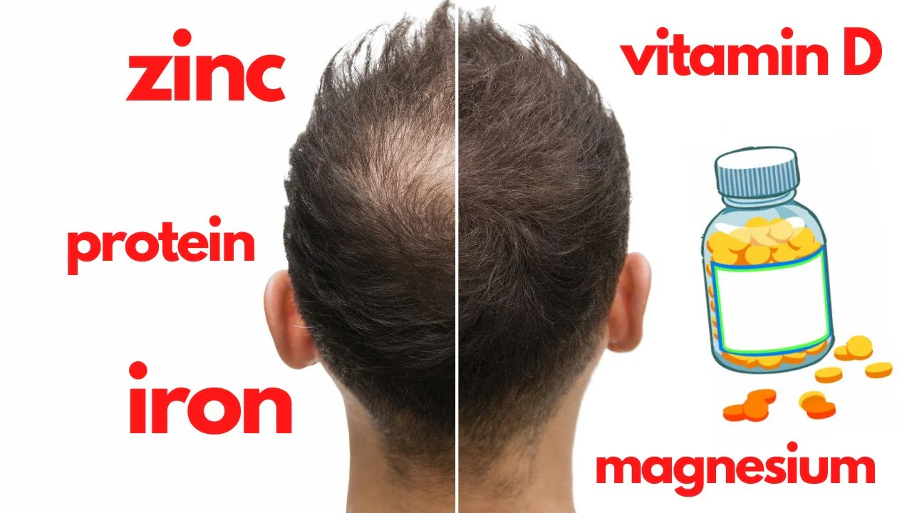 Top 10 Vitamins for Accelerating Hair Growth: What Works?