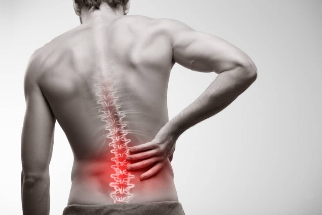 How to Manage Pain Naturally with a Herniated Disc