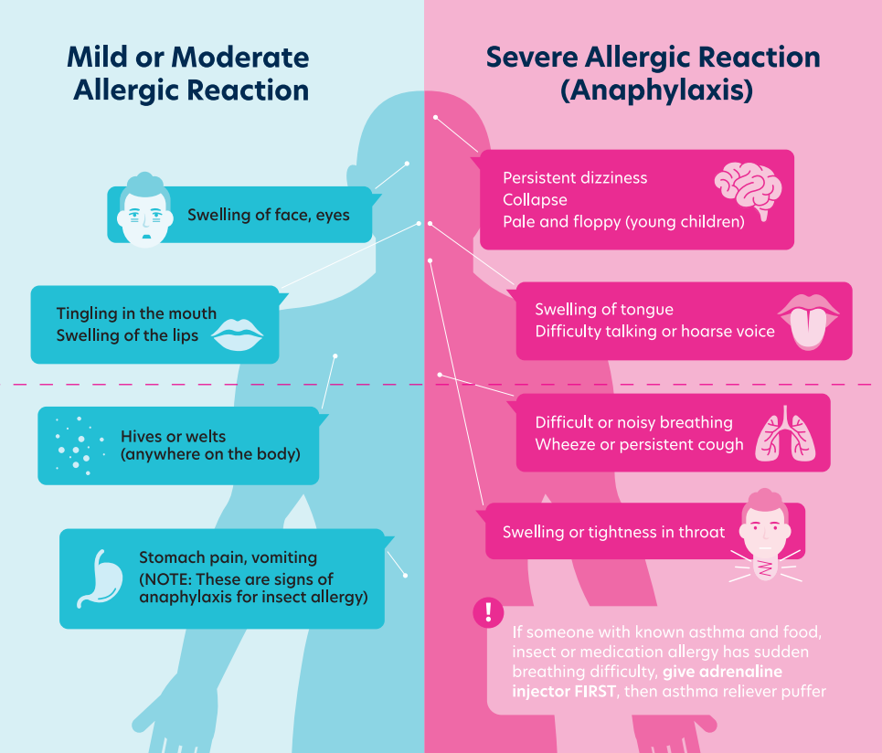 Can Allergic Reactions Occur Hours After Exposure?